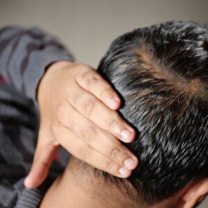 Back of a man head as he looks for hair loss.